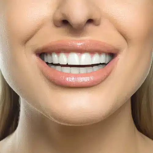 Cosmetic Dentistry